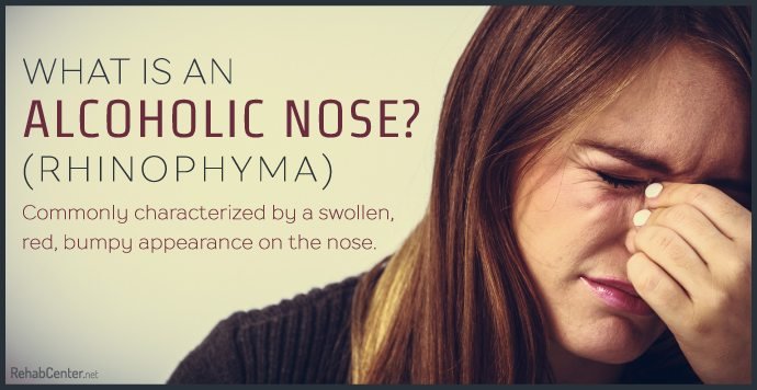 What Is Alcoholic Nose?